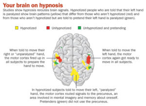 brein in hypnose